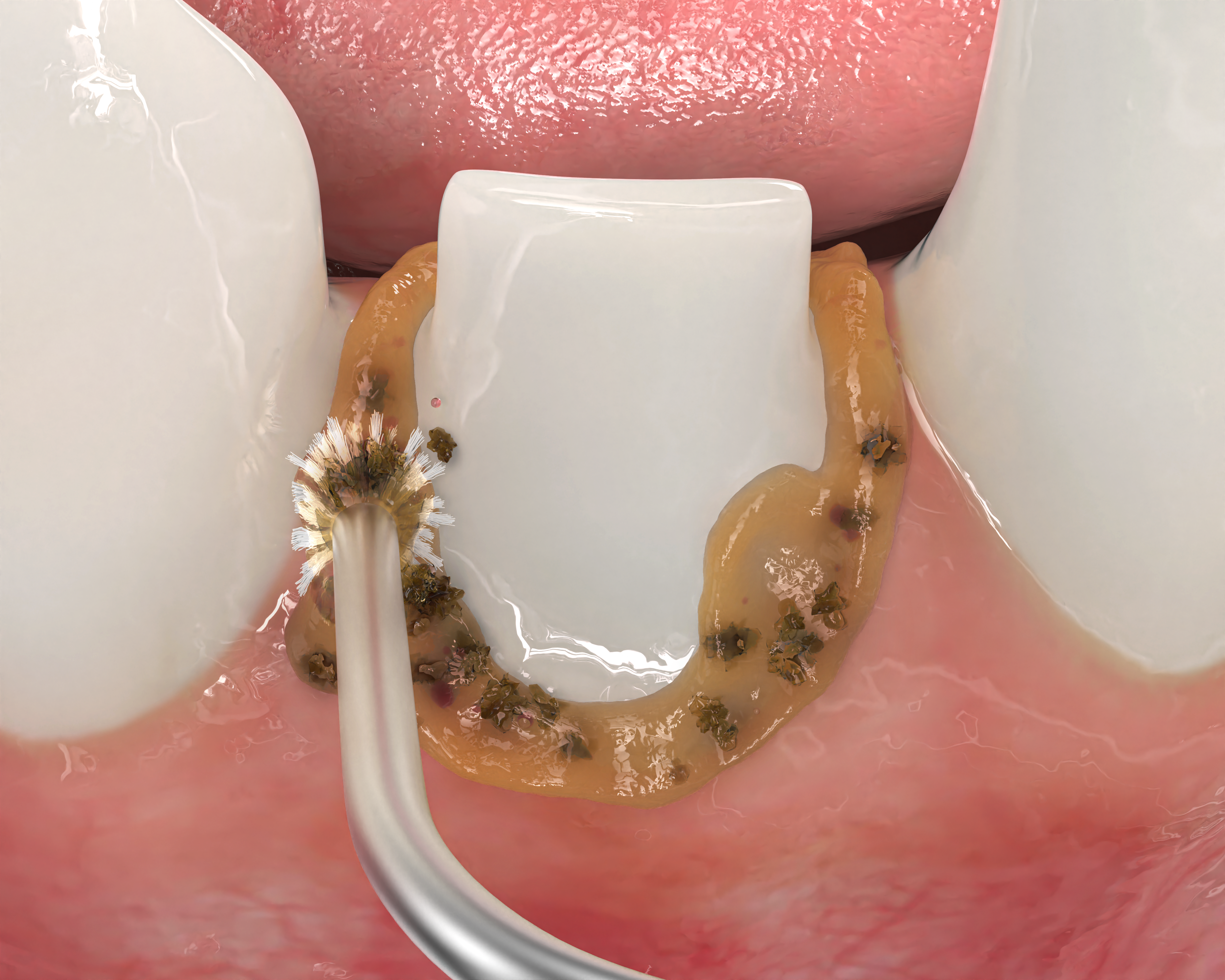 Troughing_For_Impression_Panel_1_3D_0825